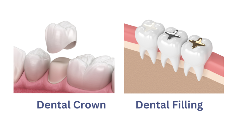 Dental Crown vs. Dental Filling visual graphic